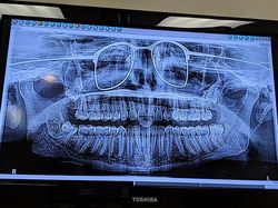 Deretan Foto X-Ray yang Mungkin Belum Pernah Kamu Lihat