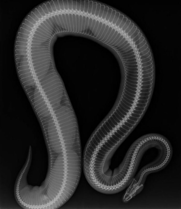 Foto X-Ray