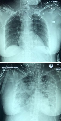 Foto X-Ray