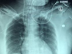 Deretan Foto X-Ray yang Mungkin Belum Pernah Kamu Lihat