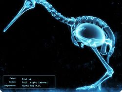 Deretan Foto X-Ray yang Mungkin Belum Pernah Kamu Lihat