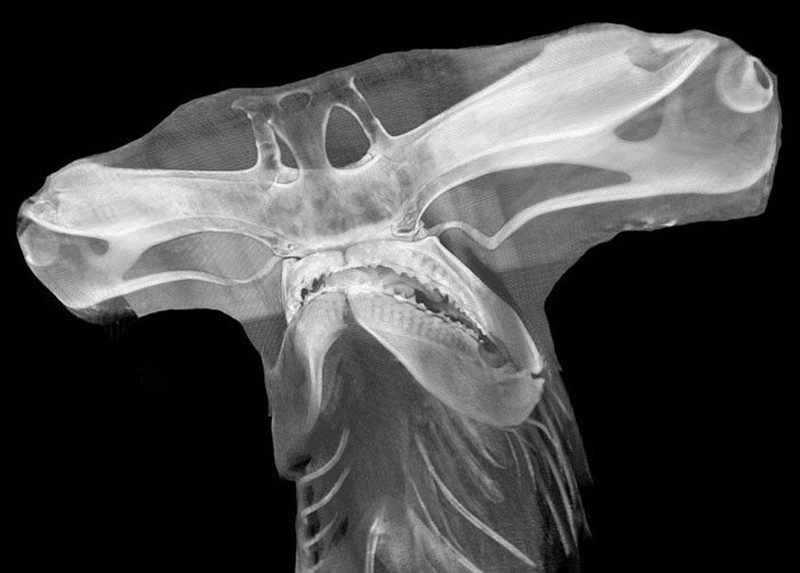 Foto X-Ray