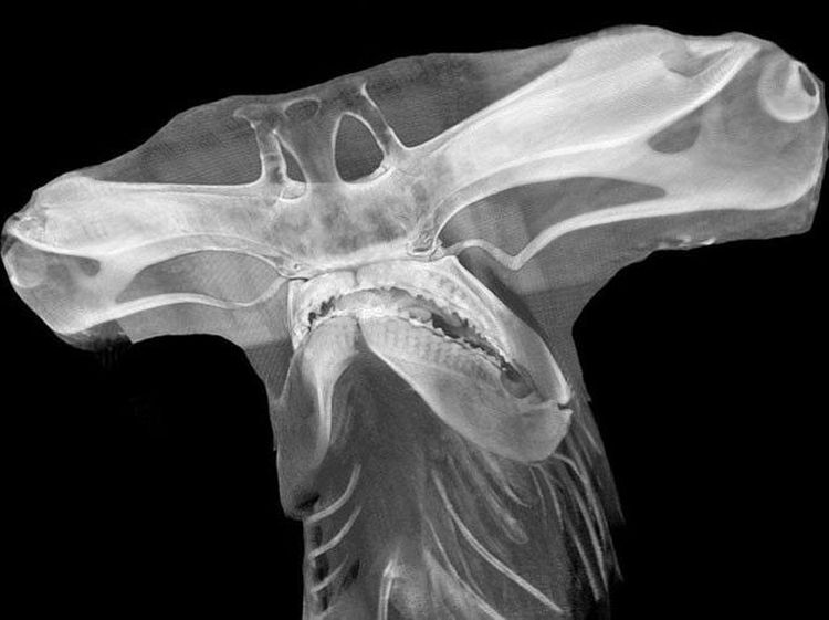 Deretan Foto X-Ray yang Mungkin Belum Pernah Kamu Lihat