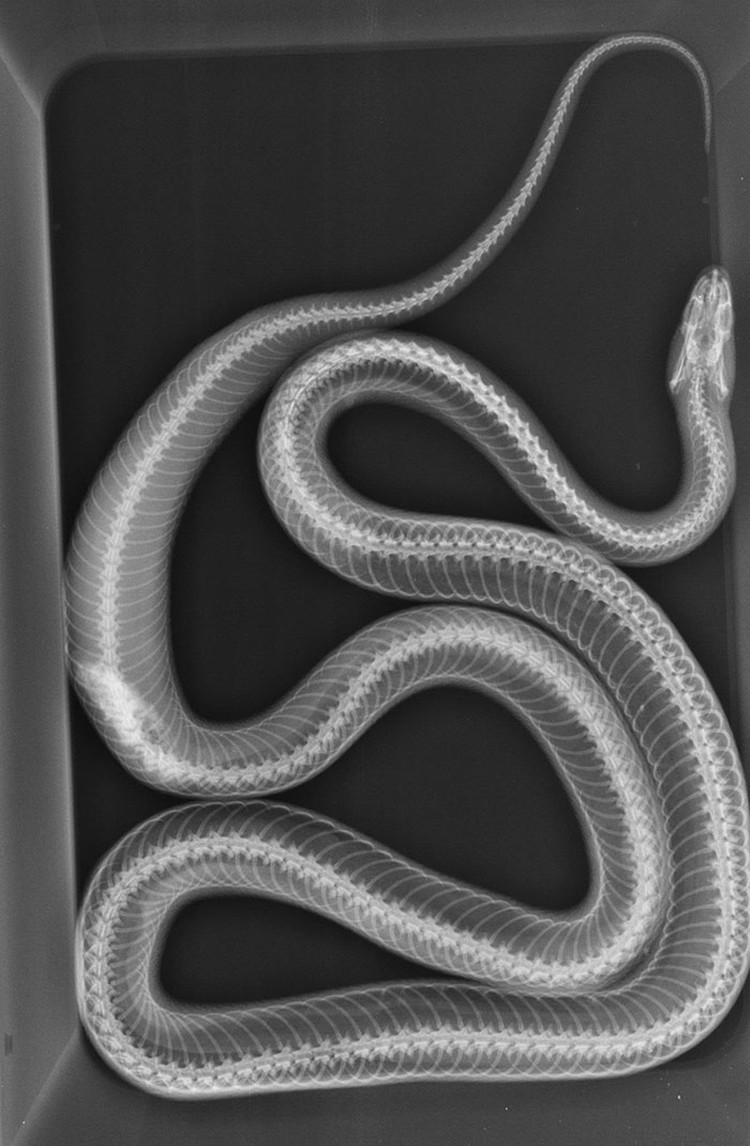Foto X-Ray