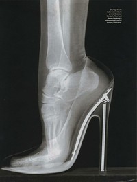 Foto X-Ray