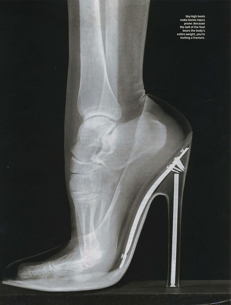 Foto X-Ray