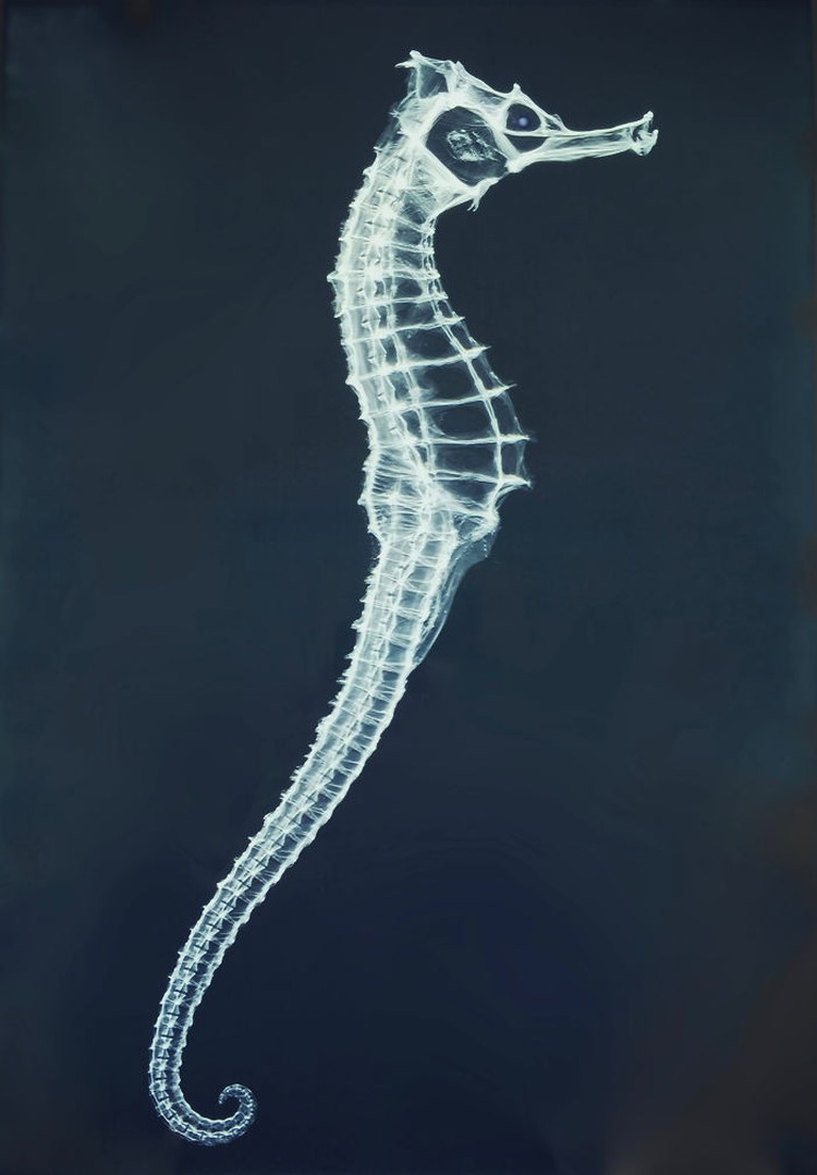 Foto X-Ray