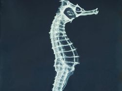 Deretan Foto X-Ray yang Mungkin Belum Pernah Kamu Lihat