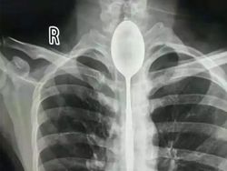Deretan Foto X-Ray yang Mungkin Belum Pernah Kamu Lihat
