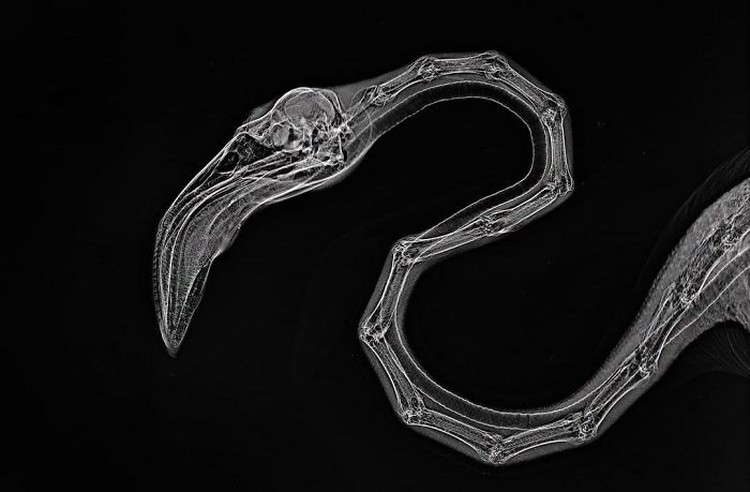 Foto X-Ray