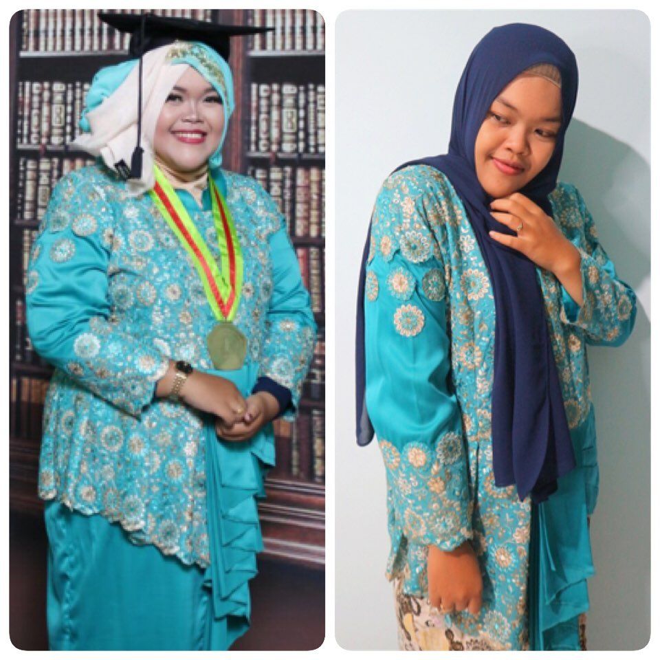 8 Tahun Diet, Wanita Ini Berhasil Turun BB 47 Kilogram