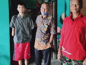 Asa Siswa SMK di Klaten Kehilangan Tangan Saat PKL untuk Bisa Kuliah
