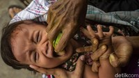Lebih lanjut, Murjiwati menjelaskan rempah-rempah yang terkandung dalam ramuan tradisional untuk cekok jamu. Adapun rempah tersebut terdiri dari temu ireng, temulawak, kunyit, daun pepaya, dan brambang puyang atau cabai dan puyang (lempuyang). detikcom bersama BRI mengadakan program Jelajah UMKM ke beberapa wilayah di Indonesia yang mengulas berbagai aspek kehidupan warga dan membaca potensi di daerah. Untuk mengetahui informasi lebih lengkap, ikuti terus beritanya di detik.com/tag/jelajahumkmbri.