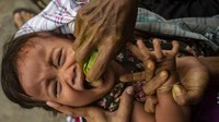 Sedangkan untuk perizinan dan pembinaannya ada di masing-masing Kabupaten/Kota. jamu cekok banyak ditemukan di desa Kiringan yang juga dikenal sebagai sentra pembuatan jamu. Foto: Rifkianto Nugroho/detikcom