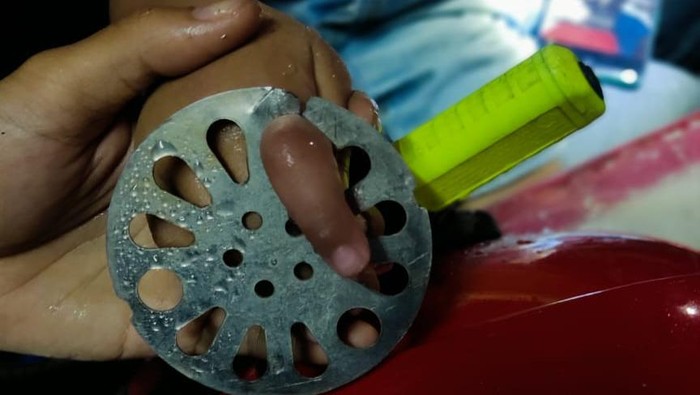 Jari tangan bocah di Setiabudi, Jaksel tersangkut floor drain. Foto dikirim Kepala Sudin Gulkarmat Jaksel, Herbert Plider Lomba Gaol