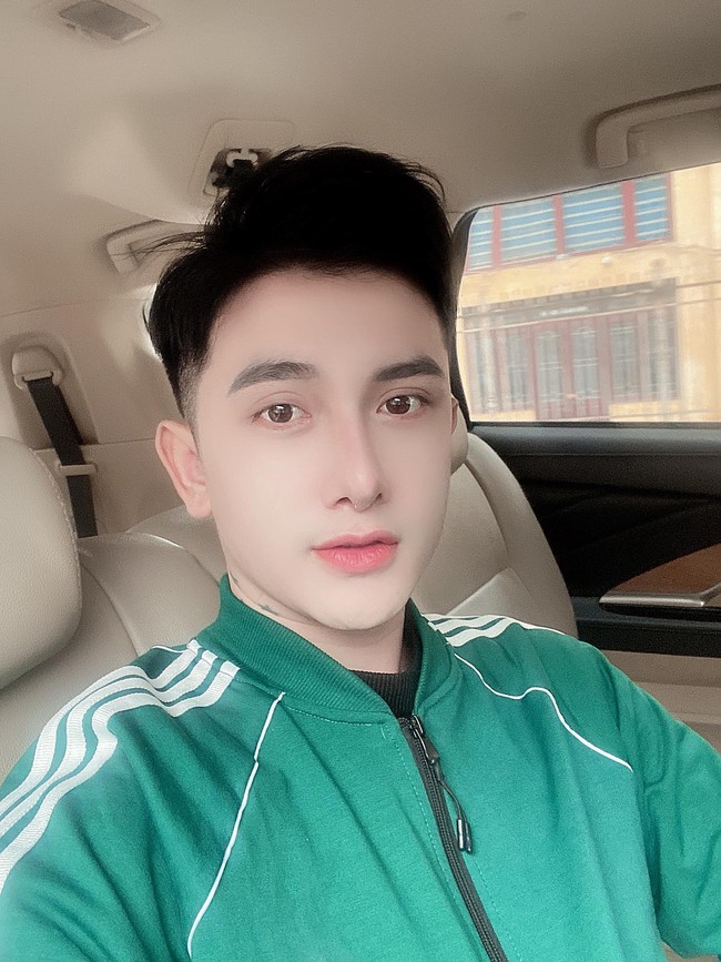 Dia melakukan operasi hidung, implan dagu, veneer gigi, operasi bibir juga operasi kelopak mata. Foto: Facebook/Do Quyen