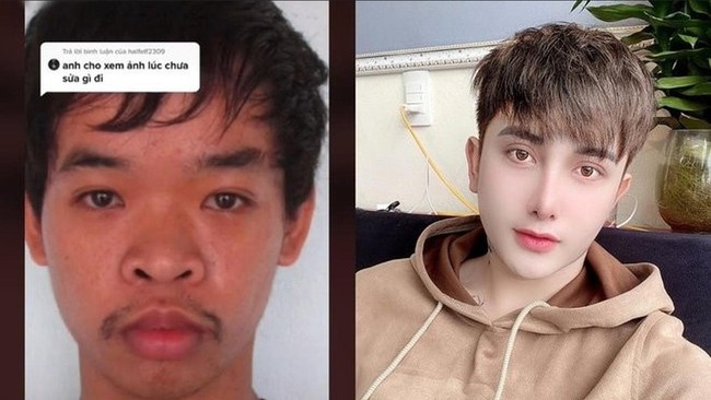 Sebelum operasi plastik, pria yang kini bekerja sebagai makeup artist ini sangat sulit mendapat pekerjaan. Dalam setiap wawancara kerja, dirinya kerapkali dicemooh karena tampilan wajahnya. Foto: TikTok/@quyen_do8