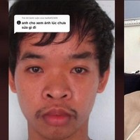 Sebelum operasi plastik, pria yang kini bekerja sebagai makeup artist ini sangat sulit mendapat pekerjaan. Dalam setiap wawancara kerja, dirinya kerapkali dicemooh karena tampilan wajahnya. Foto: TikTok/@quyen_do8