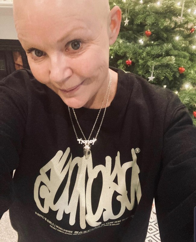 Sementara Gail menolaknya. Ia ingin menunjukkan penampilan aslinya karena ingin meningkatkan kesadaran tentang kondisinya yang masih terbilang langka. Foto: Dok. Instagram/@iamgailporter