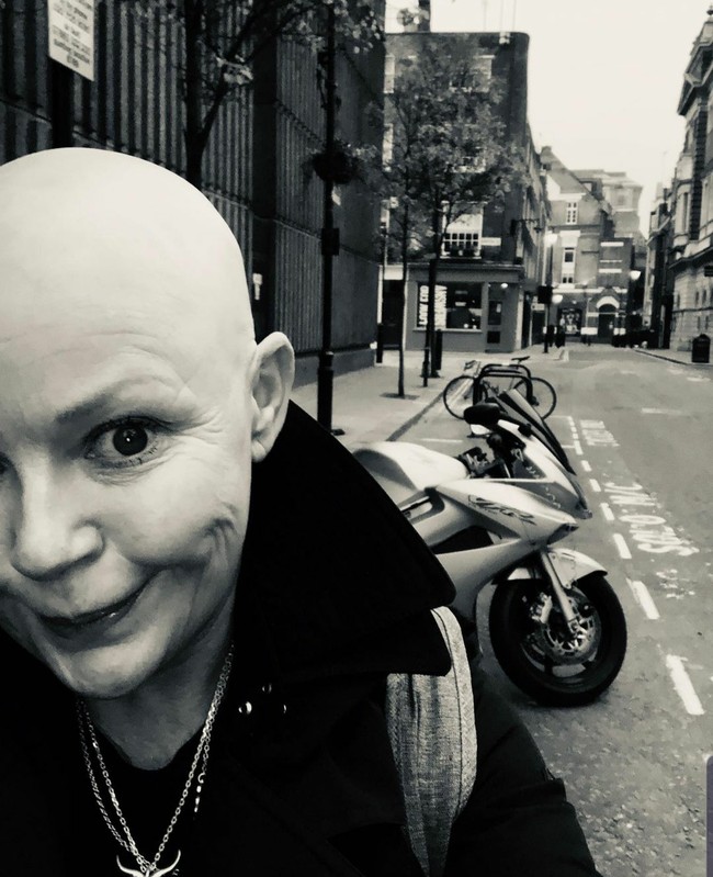 Gail Porter adalah presenter asal Inggris yang namanya populer di era 90-an. Pada 2005, dia mengalami kebotakan karena kondisi alopecia.  Foto: Dok. Instagram/@iamgailporter