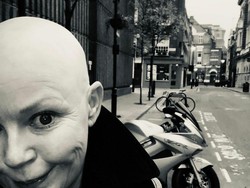 7 Potret Presenter yang Kariernya Hancur karena Botak, Sempat Jadi Gelandangan