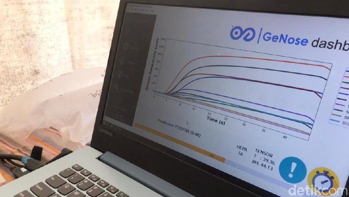 Pengalaman Tes Corona Pakai GeNose, Ternyata Begini Cara Baca Hasilnya