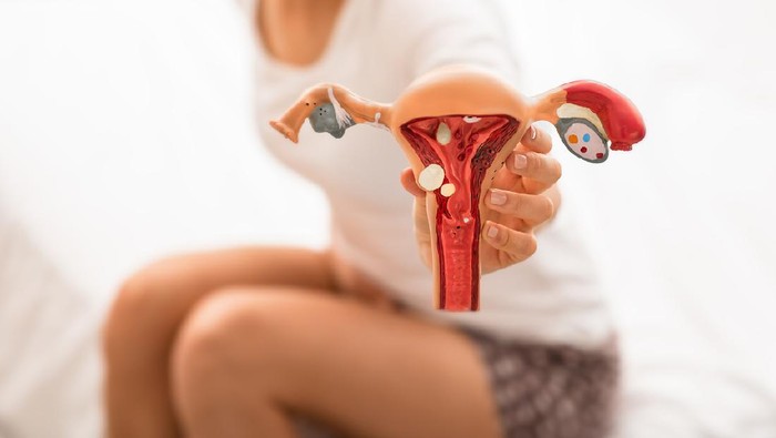 Ilustrasi rahim unrecognizing woman with abdominal pain holds the anatomical model of uterus and ovaries with pathology. diseases uterus and ovaries, endometriosis, ovarian cysts