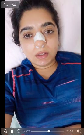 Duh! Pengantar Makanan Ini Pukul Hidung Pelanggan Wanita Sampai Berdarah