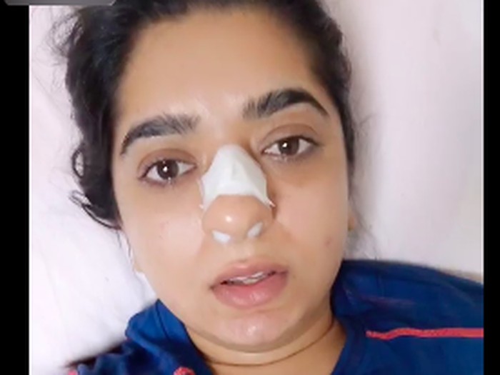 Duh! Pengantar Makanan Ini Pukul Hidung Pelanggan Wanita Sampai Berdarah