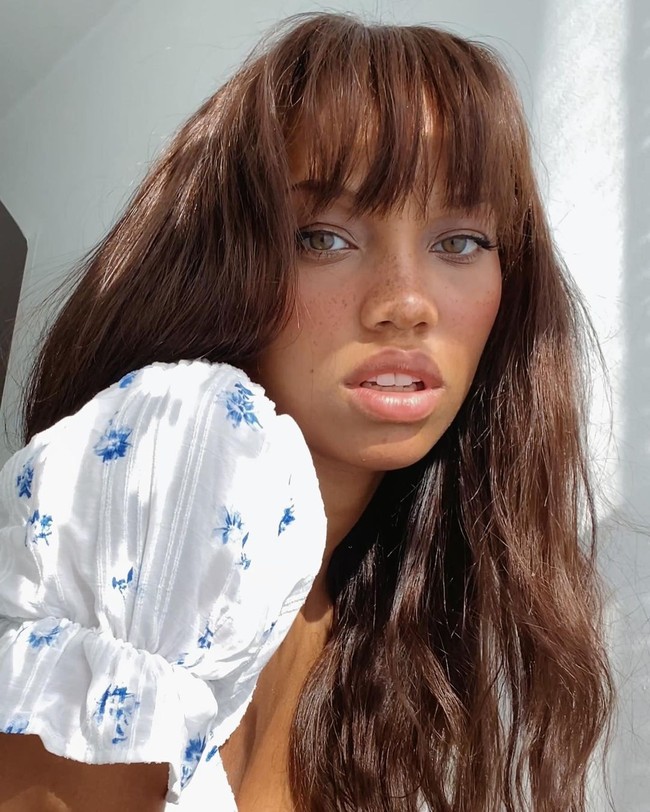 Ia lalu menjelaskan sedikit mengenai operasi tersebut. Produser yang aku lakukan adalah operasi pengecilan dahi atau operasi menurunkan garis rambut. Untuk melakukannya, mereka membuat sayatan tepat di garis rambut lalu mereka mengangkat kulit kepalamu sedikit. Mereka buat sayatan lain di mana mereka akan menurunkannya nanti kemudian mereka menyatukan dan menjahitnya, kata Camilla.  Foto: Instagram @camillacolbro