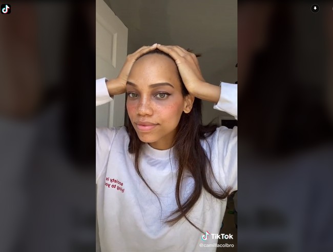 Camila mengaku tidak nyaman dengan jidat jenongnya selama 10 tahun terakhir. Ia pun berusaha selalu menutupi dengan poni. Beberapa waktu lalu Camilla memutuskan untuk menjalani dua setengah jam operasi untuk memajukan garis rambut dan mengurangi ukuran jidatnya. Tak banyak yang tahu jika ada jenis tindakan untuk itu. Foto: TikTok @camillacolbro