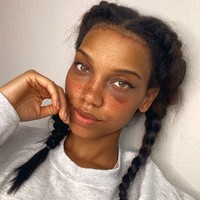 Ibu dua anak itu pun puas dengan dahinya yang mengecil 3 cm dari 8,5 cm menjadi 5,5 cm. Meski sukses mengubah sedikit penampilan tak dipungkiri jika operasi tersebut menimbulkan rasa sakit. Ia mengaku sempat tidak bisa menggerakkan alis dan dahinya terasa kebas. Hingga kini bekas operasi yang hampir berbiaya $7.000 (Rp 100 jutaan) itu masih terlihat. Foto: Instagram @camillacolbro