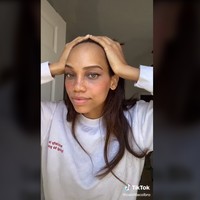 Camila mengaku tidak nyaman dengan jidat jenongnya selama 10 tahun terakhir. Ia pun berusaha selalu menutupi dengan poni. Beberapa waktu lalu Camilla memutuskan untuk menjalani dua setengah jam operasi untuk memajukan garis rambut dan mengurangi ukuran jidatnya. Tak banyak yang tahu jika ada jenis tindakan untuk itu. Foto: TikTok @camillacolbro