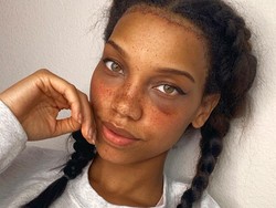 8 Foto Wanita yang Jadi Viral karena Operasi Mengecilkan Jidat Jenong