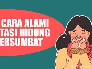 7 Cara Alami Terbebas dari Siksaan Hidung Mampet