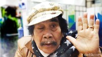 Jaja Mihardja Suntik Dengkul 40 Hari Sekali, Sakit Apaan Tuh?