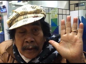 Jaja Miharja Eksis di Usia 83 Tahun, Meski Kaki Harus Disuntik 40 Hari Sekali