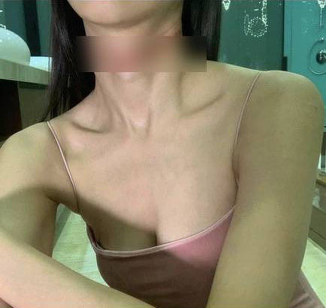 Influencer cantik Malaysia yang kerap kali memamerkan foto-foto seksinya di Instagram, Cathryn Li, baru-baru ini mengunggah sebuah postingan yang memperlihatkan percobaan bunuh dirinya. Pada unggahannya tanggal 13 Maret itu Cathryn mengatakan bahwa dirinya sedang mengalami keterpurukan emosional dan ingin mencoba mengakhiri semua rasa sakitnya itu dengan bunuh diri. Foto: dok. Instagram/Cathryn Li