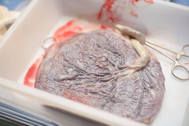 Hii.. Plasenta Manusia di China Dijual Seperti Ayam Goreng Krispi