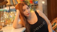Filler yang dipasang Monica Indah memang terbilang cukup murah yaitu Rp 14 juta dan sempat diiklankan oleh seorang selebgram. (Foto: Dokumentasi Pribadi Monica Indah) 
