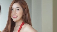 Namun sayangnya, filler tersebut gagal dan membuat Monica Indah merasakan sakit. (Foto: Dokumentasi Pribadi Monica Indah) 