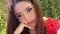 Lantaran Monica Indah memasang filler yang niatnya buat memperbesar. (Foto: Dokumentasi Pribadi Monica Indah) 