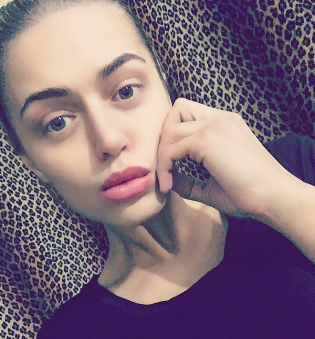 Butuh penanganan segera, ia pun meminta bantuan netizen untuk menyumbang uang dengan meninggalkan nomor rekening di postingan media sosial. Aku tidak pernah minta atau menerima bantuan dari orang lain tapi sekarang aku benar-benar tidak bisa siapa pun untuk dimintai tolong, tuturnya. Foto: Instagram @nastenabalinskaya