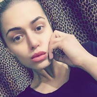 Butuh penanganan segera, ia pun meminta bantuan netizen untuk menyumbang uang dengan meninggalkan nomor rekening di postingan media sosial. Aku tidak pernah minta atau menerima bantuan dari orang lain tapi sekarang aku benar-benar tidak bisa siapa pun untuk dimintai tolong, tuturnya. Foto: Instagram @nastenabalinskaya