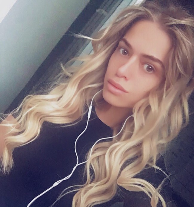 Ternyata Anastasia sudah mengalami hal ini selama lima tahun belakangan. Ia sudah tiga kali operasi dan kondisi hidungnya bertambah parah. Aku tidak mengejar kecantikan sekarang, aku hanya ingin bernapas, hidung yang datar. Setelah operasi terakhir, tulangku terbelah dan batang hidungku terlihat aku habis dipukuli di ring tinju, katanya. Foto: Instagram @nastenabalinskaya