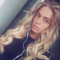 Ternyata Anastasia sudah mengalami hal ini selama lima tahun belakangan. Ia sudah tiga kali operasi dan kondisi hidungnya bertambah parah. Aku tidak mengejar kecantikan sekarang, aku hanya ingin bernapas, hidung yang datar. Setelah operasi terakhir, tulangku terbelah dan batang hidungku terlihat aku habis dipukuli di ring tinju, katanya. Foto: Instagram @nastenabalinskaya