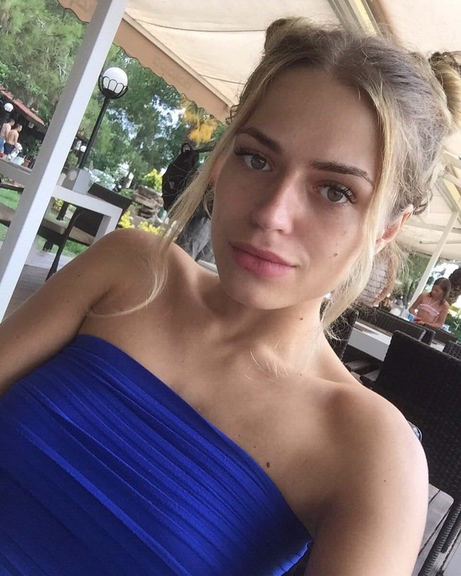 Kemarin aku pergi ke dokter dan mengetahui implan buatan yang dimasukan di ujung hidung tidak mengambil akarnya, tubuhku menolaknya, tulang rawannya keluar dari satu lubang, ada inflamasi, dan hidungku membusuk, jelas Anastasia. Foto: Instagram @nastenabalinskaya