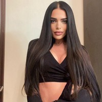 Anastasia mengatakan implan yang dimasukkan ke hidungnya menyebabkan reaksi. Wanita cantik itu sudah diberikan obat antibiotik dan cairan untuk hidung tapi dikatakan hanya menunggu waktu sebelum benar-benar membusuk. Dokter mengatakan aku punya sebulan, maksimal dua bulan, sampai semuanya membusuk, katanya. Foto: Instagram @nastenabalinskaya