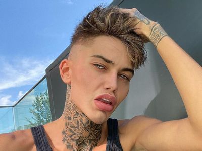 7 Foto Pria yang Habis Operasi Plastik Malah Diejek Mirip Squidward