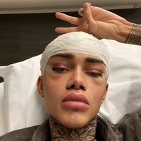 Levi sendiri mengaku bahwa dia melakukan operasi plastik bukan berarti tidak percaya diri dengan wajah aslinya. Namun dia mengaku bosan dengan penampilannya yang begitu-begitu saja. Foto: dok. Instagram